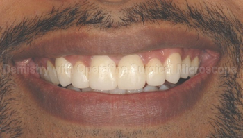 After treatment - Smile